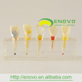 EN-M6 Best Price Dental Pulp Disease Clinical Model from Manufacturer Directly